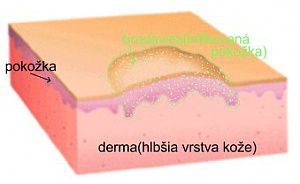 veruka 11 625x378