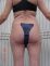 Liposukcia