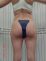 Liposukcia