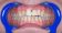 American Dental Dentálna hygiena