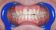 American Dental Dentálna hygiena