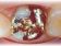 Dentální centrum - MUDr. Rafael Chajrušev Cerec (zákroky pomocou robotov)