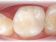 Dentální centrum - MUDr. Rafael Chajrušev Cerec (zákroky pomocou robotov)